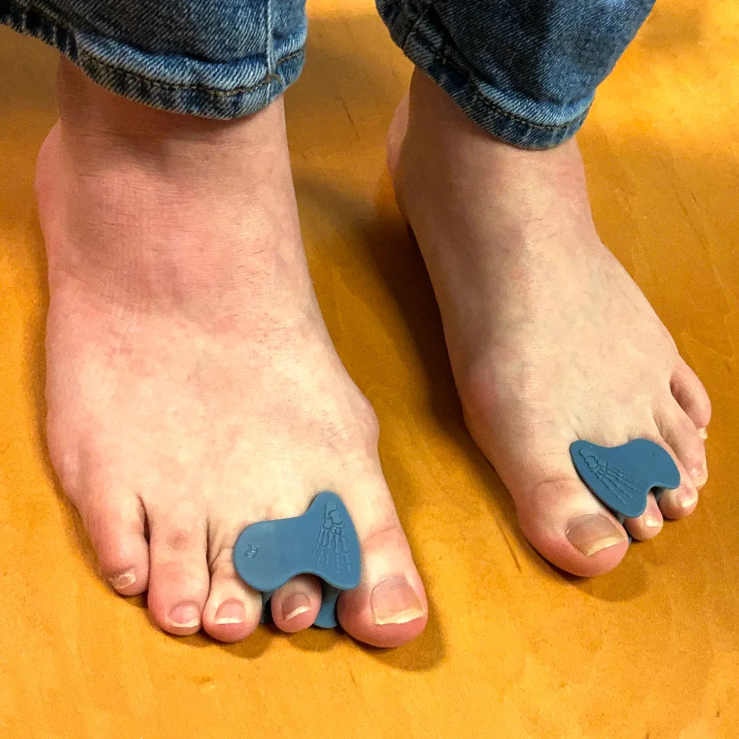 Correct Toes® - Stable Toe - Image 14